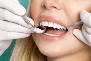 woman with veneers