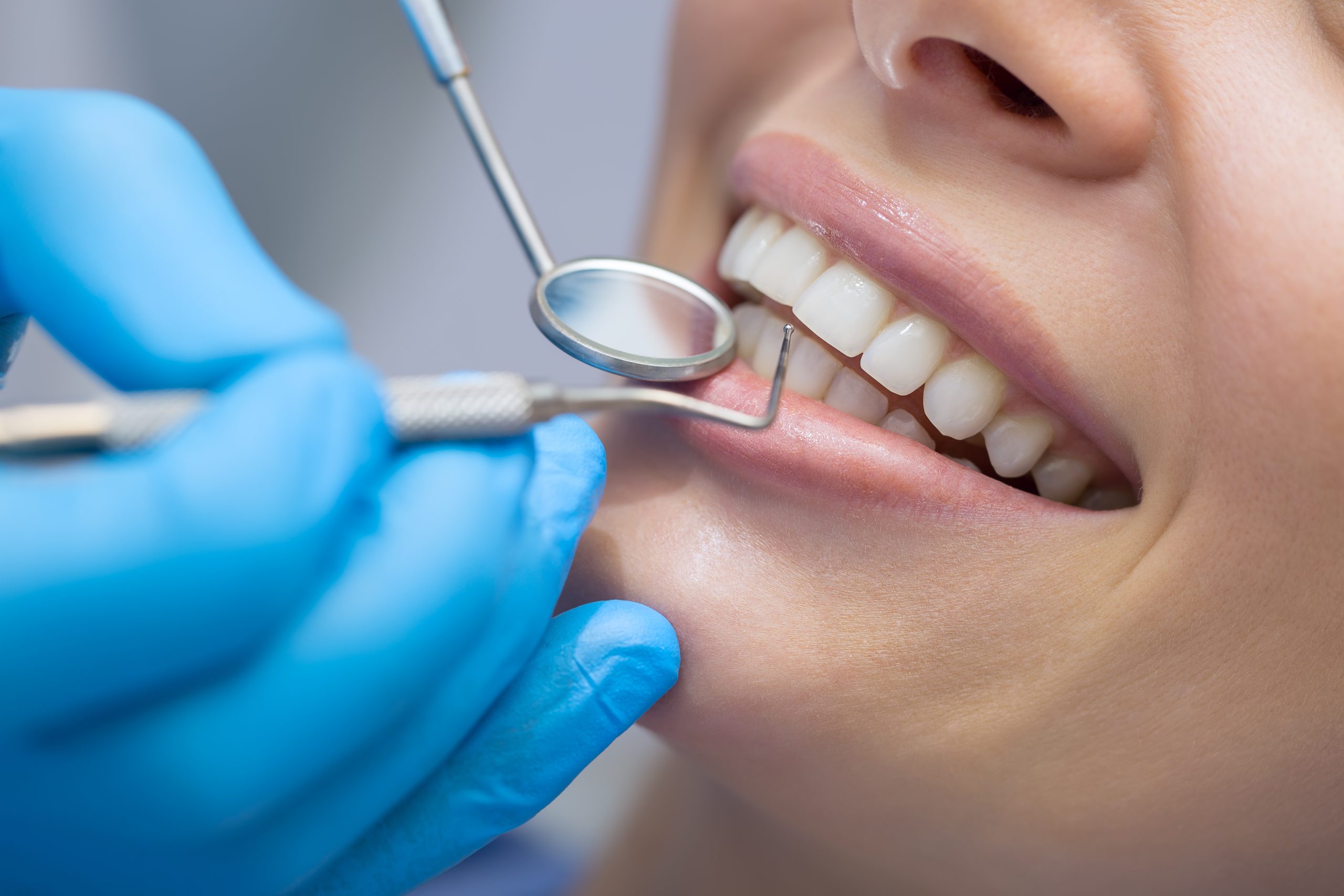 person getting a dental exam