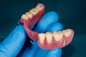 Partial,Removable,Denture